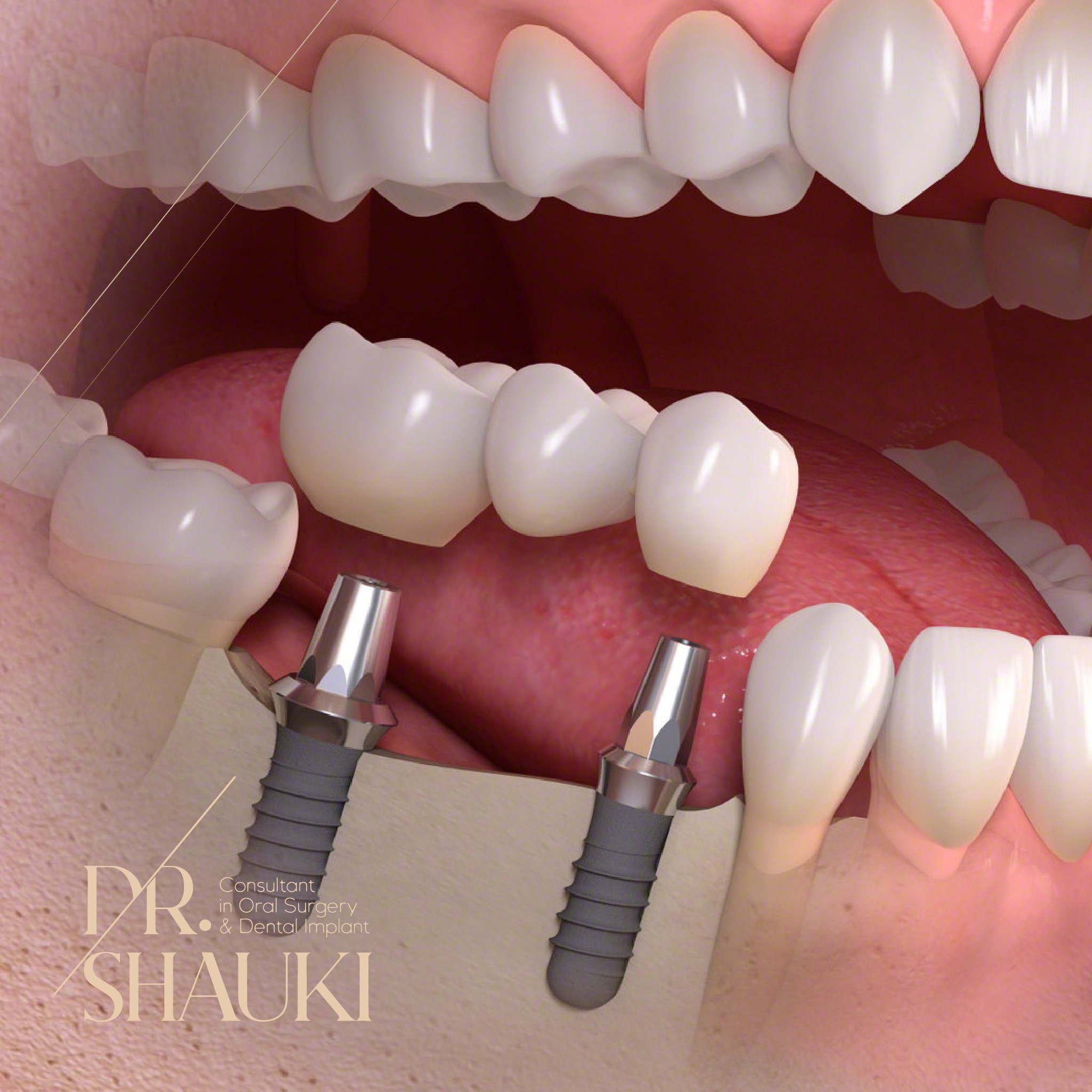 https://drshauki.com/wp-content/uploads/2021/10/Dr.-Shauki-Dental-Health-11.jpg